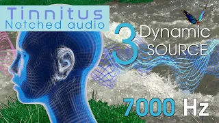 Tinnitus Sound Therapy: Natural 7000 Hz Notched Audio with 3 Dynamic Sound Sources
