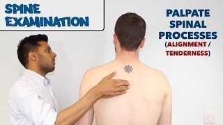 Spine Examination - OSCE Guide (old version) | UKMLA | CPSA