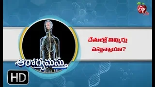 Symptoms of B 12 Deficiency  | Aarogyamastu | 13th June 2019 | ETV Life