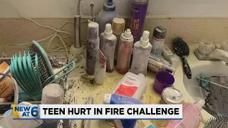 Portland Teen in ICU after attempting fire TikTok challenge