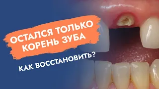 Остался только корень зуба. Как восстановить?