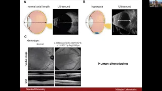 Genetics and Associated Diseases - Inherited retinopathy and ODD