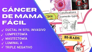 FÁCIL Cancer de mama RESUMEN