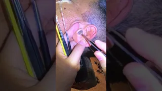 Ear Cleaning