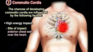 Sudden Cardiac Death In Athletes - Everything You Need To Know - Dr. Nabil Ebraheim
