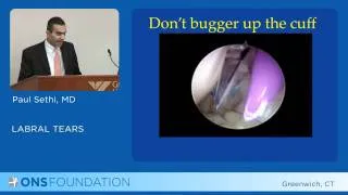 Labral Tears of the Shoulder by Paul Sethi, MD