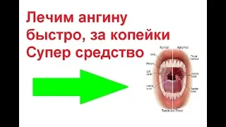 Лучшее и безопасное средство от ангины 100%