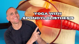 How to Practice Yoga with Spondylolisthesis