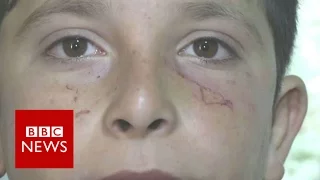 Syria refugee children 'bitten by rats' in camps - BBC News
