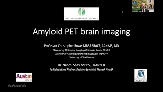 Amyloid PET Brain Imaging