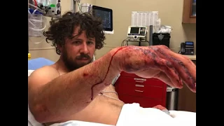 Shepherd man survives attack by grizzly bear