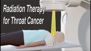 Throat Cancer Radiation Therapy - Long Version