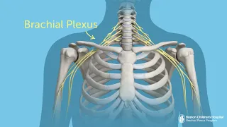 What Is Brachial Plexus Injury? | Boston Children’s Hospital