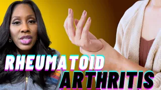 What Are the SYMPTOMS of RHEUMATOID ARTHRITIS? What Are the Treatments? A Doctor Explains