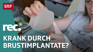 Risiko Brustimplantate – Was steckt hinter «Breast Implant Illness»? | Reportage | rec. | SRF