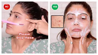 😱5 Skincare Mistakes That Make Your Acne Worse & Sensitize Your Skin! | Rinkal Parekh