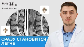 Как избавиться от протрузий и грыж в пояснице.