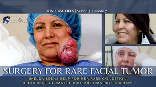 Surgery to Remove a Large Facial Tumor | Dermatofibrosarcoma Protuberans (DFSP)