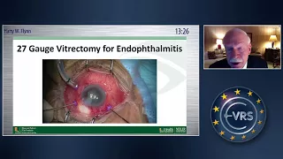 Relja Zivojnovic Award Lecture – Vitrectomy and Endophthalmitis