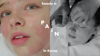 Can Korea Cure My Acne? 💉 Beauty Is PAIN in Korea !! #SisSelfCare | Sissel