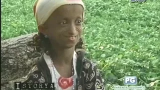 ISTORYA: "Iba", the life of a Progeria patient