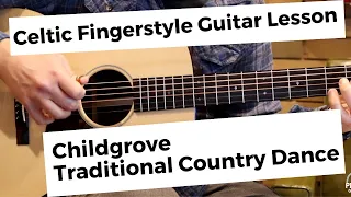 Childgrove: Celtic Fingerstyle Guitar Lesson