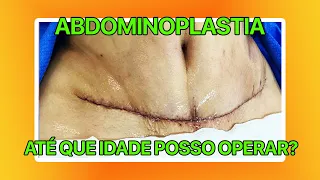 ABDOMINOPLASTIA ATÉ QUE IDADE POSSO OPERAR? CIRURGIA PLÁSTICA