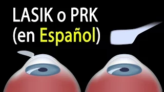LASIK o PRK? Cuál es el adecuado para mí? Alila Medical Media Español.