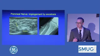 SMUG Jon Jacobson Masterclass 2019. MSKUS lower limb peripheral nerve entrapment sites. Presentation