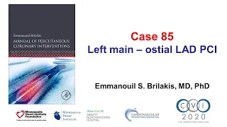 Case 85: PCI Manual - Ostial left main/LAD bifurcation stenting