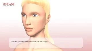 Facelift Animation - Boerhaave Medical Centre