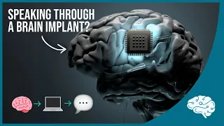 Brain Implant Restores Speech to Paralyzed Man