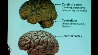 “Normal and Abnormal Brain Development in Children” -- Ronald Yeo