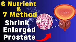 TOP 6 Nutrient and 7 Method to Shrink Your Enlarged Prostate | Christiansen Felix