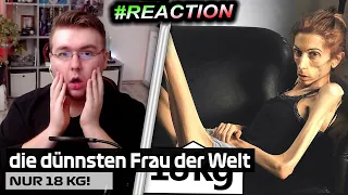 REACTION auf Das traurige Leben der dünnsten Frau der Welt! 😮 - Wissenswert | #iToJuReaction