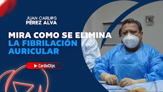 MIRA COMO SE ELIMINA LA FIBRILACIÓN AURICULAR