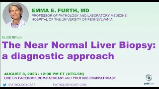 #LIVERPATH The Near Normal Liver Biopsy: a diagnostic approach