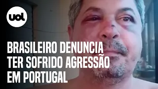 Brasileiro é espancado após ser vítima de xenofobia em Portugal