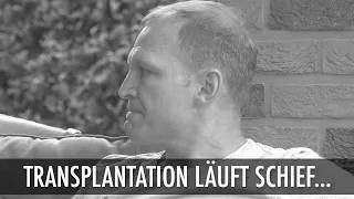 Haartransplantation läuft 2 x MAL!!! schief...