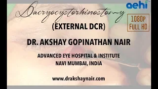 External Dacryocystorhinostomy (DCR)  Full HD  -  Dr Akshay G. Nair at Advanced Eye Hospital (AEHI)