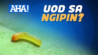 Lalaki na may iniindang sakit sa ngipin, uod ang itinuturong dahilan?! | AHA!