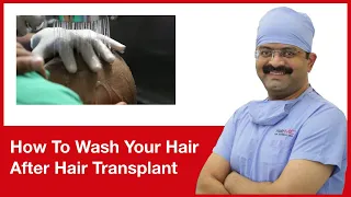 How To Wash Your Hair After Hair Transplant | HairMD, Pune | (In HINDI)