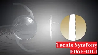 Tecnis Symfony EDoF ИОЛ с расширенной глубиной фокуса. Обзор и сравнение с мультифокальными линзами