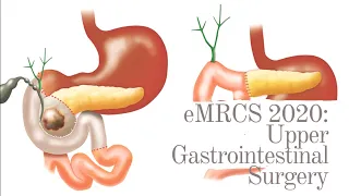 Upper Gastrointestinal Surgery