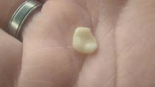 Customer says he found human tooth in food at Newark restaurant