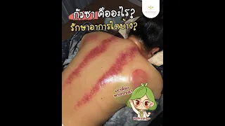 กัวซา คืออะไร? รักษาอาการปวดใดได้บ้าง? | Refreshy Clinic