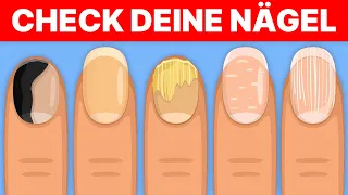 5 Dinge, die deine Nägel über deine Gesundheit aussagen!