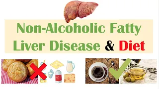 Non-Alcoholic Fatty Liver Disease & Diet | Diets to Prevent and Reduce Severity of NAFLD