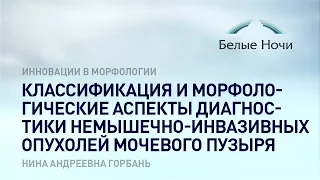 Классификация и морфологические аспекты диагностики немышечно-инвазивных опухолей мочевого пузыря