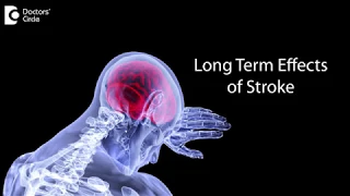 What are the long term effects of having a stroke? - Dr.Anil R
